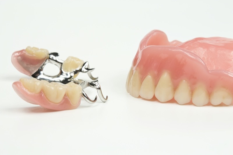 入れ歯（義歯）の種類
